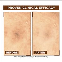 Night Vitamin C Serum Before After